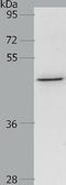 C-C Motif Chemokine Receptor 3 antibody, TA323966, Origene, Western Blot image 