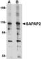 DLG Associated Protein 2 antibody, orb74999, Biorbyt, Western Blot image 