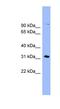 Leucine-rich repeat-containing protein 52 antibody, NBP1-70625, Novus Biologicals, Western Blot image 