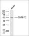 Zinc Finger And BTB Domain Containing 7C antibody, orb158764, Biorbyt, Western Blot image 