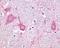 Metabotropic glutamate receptor 5 antibody, orb85919, Biorbyt, Immunohistochemistry paraffin image 