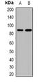 Amyloid Beta Precursor Protein antibody, orb382655, Biorbyt, Western Blot image 