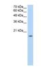 Zinc Finger Protein 580 antibody, NBP1-80333, Novus Biologicals, Western Blot image 