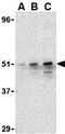Interferon Regulatory Factor 7 antibody, GTX85490, GeneTex, Western Blot image 