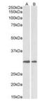 Lysyl Oxidase antibody, orb373006, Biorbyt, Western Blot image 