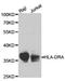Major Histocompatibility Complex, Class II, DR Alpha antibody, TA327089, Origene, Western Blot image 