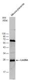 Lin-28 Homolog A antibody, NBP2-43672, Novus Biologicals, Western Blot image 