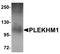 Putative pleckstrin homology domain-containing family M member 1P antibody, A07959, Boster Biological Technology, Western Blot image 