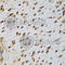 Nucleolin antibody, A5904, ABclonal Technology, Immunohistochemistry paraffin image 