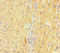 Potassium Voltage-Gated Channel Subfamily A Member 6 antibody, A62810-100, Epigentek, Immunohistochemistry paraffin image 