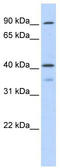 2'-5'-Oligoadenylate Synthetase 1 antibody, TA339209, Origene, Western Blot image 