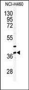 Pantothenate Kinase 3 antibody, AP13806PU-N, Origene, Western Blot image 