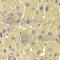 Aldehyde Dehydrogenase 1 Family Member L1 antibody, A7067, ABclonal Technology, Immunohistochemistry paraffin image 