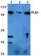 Toll Like Receptor 4 antibody, LS-B14142, Lifespan Biosciences, Western Blot image 