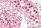MutS Homolog 5 antibody, orb19935, Biorbyt, Immunohistochemistry paraffin image 