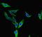 Bromodomain adjacent to zinc finger domain protein 2A antibody, LS-C677280, Lifespan Biosciences, Immunofluorescence image 