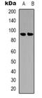 B-Raf Proto-Oncogene, Serine/Threonine Kinase antibody, orb318900, Biorbyt, Western Blot image 