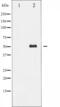 Melanocyte Inducing Transcription Factor antibody, abx011151, Abbexa, Western Blot image 