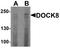 Dedicator of cytokinesis protein 8 antibody, A01771, Boster Biological Technology, Western Blot image 