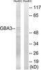 Glucosylceramidase Beta 3 (Gene/Pseudogene) antibody, TA312392, Origene, Western Blot image 