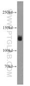 Galectin 12 antibody, 22398-1-AP, Proteintech Group, Western Blot image 