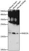 RAB22A, Member RAS Oncogene Family antibody, LS-C750457, Lifespan Biosciences, Western Blot image 