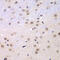 RING1b antibody, 19-735, ProSci, Immunohistochemistry paraffin image 