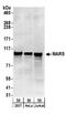 Methionyl-TRNA Synthetase antibody, A303-960A, Bethyl Labs, Western Blot image 