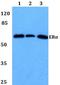 Estrogen Receptor 1 antibody, AP06110PU-N, Origene, Western Blot image 