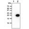 NME/NM23 Nucleoside Diphosphate Kinase 2 antibody, GTX57712, GeneTex, Western Blot image 
