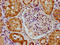 Cyclin And CBS Domain Divalent Metal Cation Transport Mediator 2 antibody, LS-C680300, Lifespan Biosciences, Immunohistochemistry paraffin image 