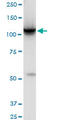 Hexokinase-2 antibody, LS-C197412, Lifespan Biosciences, Western Blot image 