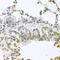 BAX antibody, A0207, ABclonal Technology, Immunohistochemistry paraffin image 