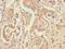 STT3 Oligosaccharyltransferase Complex Catalytic Subunit A antibody, A63520-100, Epigentek, Immunohistochemistry paraffin image 