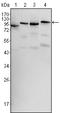 B-Raf Proto-Oncogene, Serine/Threonine Kinase antibody, STJ98351, St John