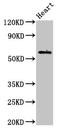 BCL3 Transcription Coactivator antibody, CSB-PA002623LA01HU, Cusabio, Western Blot image 