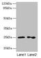 RAB11B, Member RAS Oncogene Family antibody, CSB-PA614903LA01HU, Cusabio, Western Blot image 