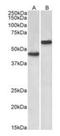 Lymphatic Vessel Endothelial Hyaluronan Receptor 1 antibody, orb233665, Biorbyt, Western Blot image 