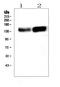 ADAMTS13 antibody, PB10028, Boster Biological Technology, Western Blot image 