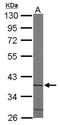 Aminocarboxymuconate Semialdehyde Decarboxylase antibody, NBP1-33499, Novus Biologicals, Western Blot image 