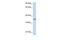 HEXIM P-TEFb Complex Subunit 2 antibody, GTX47216, GeneTex, Western Blot image 