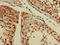 Glutathione S-Transferase Theta 1 antibody, LS-C375857, Lifespan Biosciences, Immunohistochemistry paraffin image 