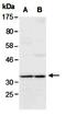 Ribosomal Protein L5 antibody, orb67036, Biorbyt, Western Blot image 