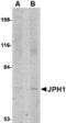 Junctophilin 1 antibody, TA306681, Origene, Western Blot image 