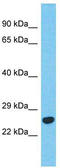 Branched Chain Keto Acid Dehydrogenase E1 Subunit Beta antibody, TA344275, Origene, Western Blot image 