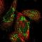 Translocase Of Inner Mitochondrial Membrane 29 antibody, NBP1-94151, Novus Biologicals, Immunocytochemistry image 
