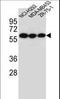 Cholinergic Receptor Nicotinic Alpha 10 Subunit antibody, LS-B12848, Lifespan Biosciences, Western Blot image 