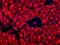 Human Pancreas Exocrine Cell Marker 1 antibody, MA5-16132, Invitrogen Antibodies, Immunofluorescence image 