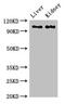 Complement C6 antibody, CSB-PA004036LA01HU, Cusabio, Western Blot image 