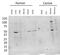 Dicer 1, Ribonuclease III antibody, PA5-11808, Invitrogen Antibodies, Western Blot image 